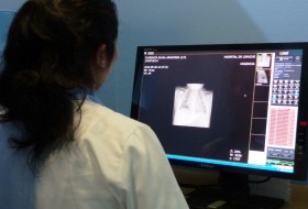 Nuevo equipo de rayos X para el hospital Santo Tomás de Limache.