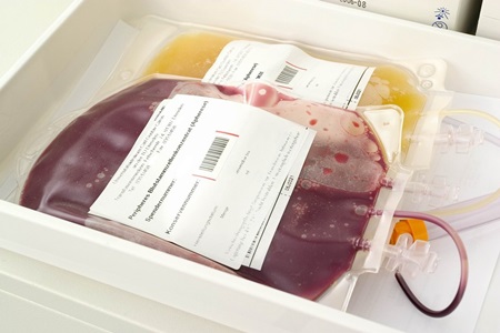 Cada una hora, una persona es diagnosticada con  cáncer de sangre en Chile.