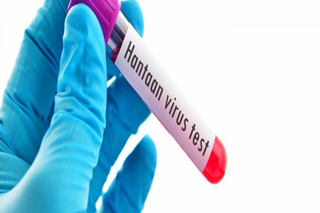 Guía para prevenir el contagio de virus Hanta.