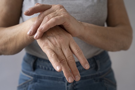 Osteoporosis: ¿Puede el Omega 3 convertirse en un aliado contra esta afección?.